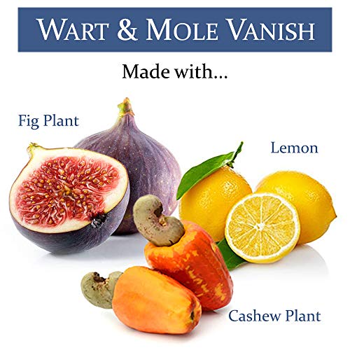 Wart & Mole Vanish - Kit Para Eliminar Verrugas Y Lunares - Elimina Las Verrugas Y Lunares De Forma Natural Y Eficaz - Kit Completo De Eliminación De Todo Tipo De Verrugas