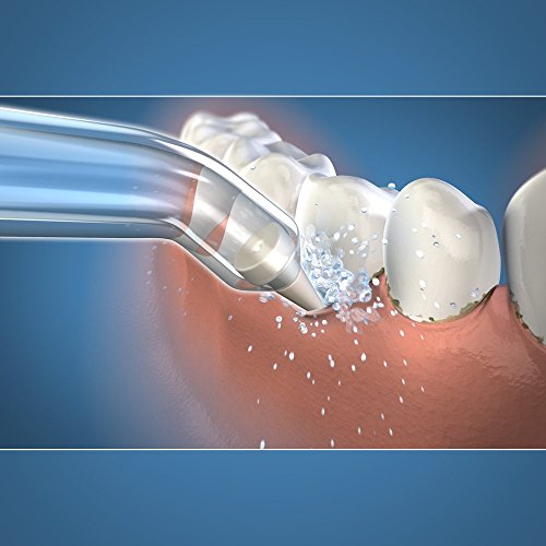 Waterpik PP-100E - Producto de cuidado dental