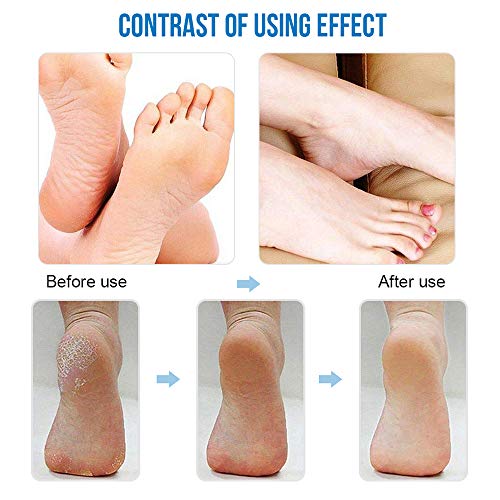 WaVes Electrica Pies,Removedor de callos eléctrico con pantalla LED de alimentación,Incluye 3 cabezas de rodillo y 1 cepillo de limpieza