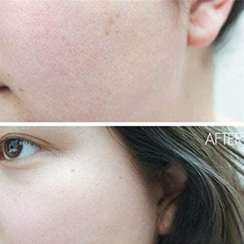 XYDD The Ordinary Women Peeling Solution Facial Serums 30ml AHA 30% + BHA 2%