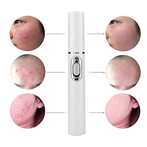 Yaogroo 2018 Spider Vein Eraser Araña Vena Borrador-Potente Anti-varices Eliminación Pen