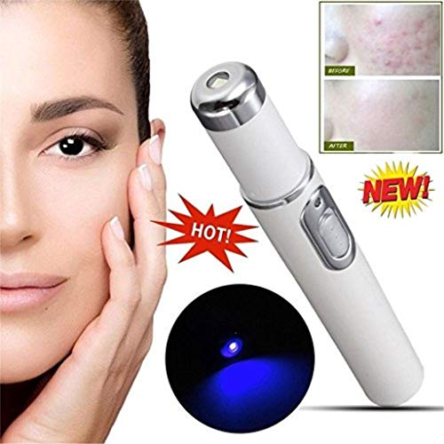 Yaogroo 2018 Spider Vein Eraser Araña Vena Borrador-Potente Anti-varices Eliminación Pen