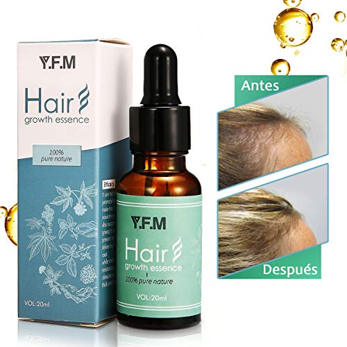 Y.F.M Crecimiento de Cabello, Tratamiento para el Cabello, Aceite para el Crecimiento de Pelo, Hair Serum, Estimula el Crecimiento de Pelo para Hombres y Mujeres