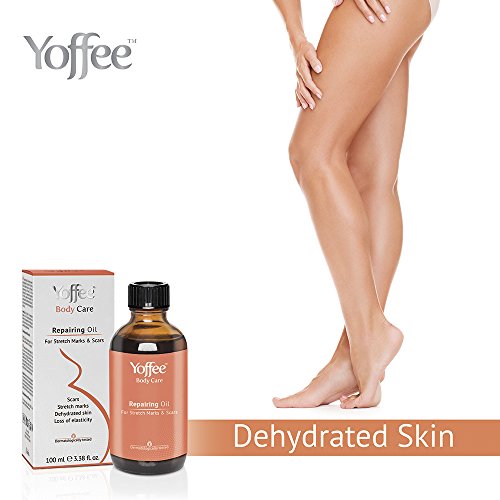 Yoffee - Aceite Reparador 100% Natural, Aceite para Masajes, Elimina Estrías y Cicatrices, Apto para Mujeres Embarazas y Lactancia, Libre de Parabenos y Sulfatos, Vegano, 100ML