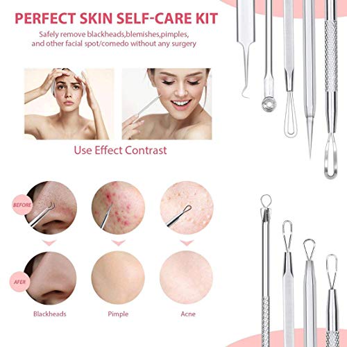 Yolistar Aguja Extractor Limpiador 9 Pcs, Blackhead, Acné, Comedones Remover, Juego de Cabeza Doble de Acero Inoxidable, Acné Punto Negro Extractor Herramientas