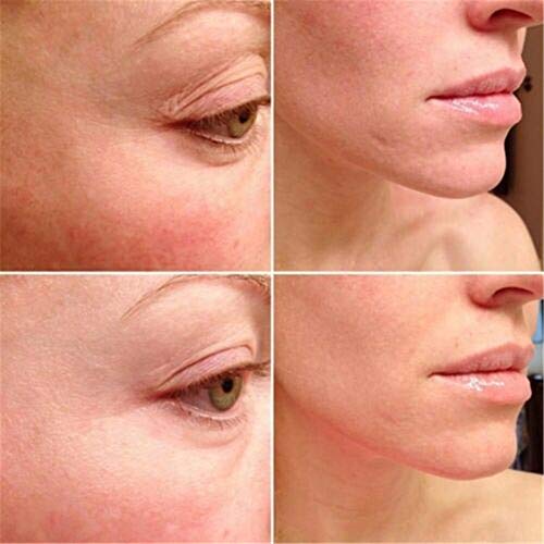 ZGBQ The Ordinary Granactive Retinoid 2% Emulsión Serum Facial antienvejecimiento 30ml (30ml)