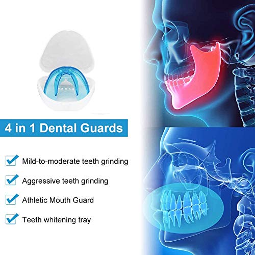 3 X Férula Dental de Descarga, Ferula Descarga Nocturna Anti Bruxismo, Nuevo Tipo Férula Descarga Dental Protector Bucal Cuidado para Dormir,Blanqueamiento Dental,Atletas,Negro