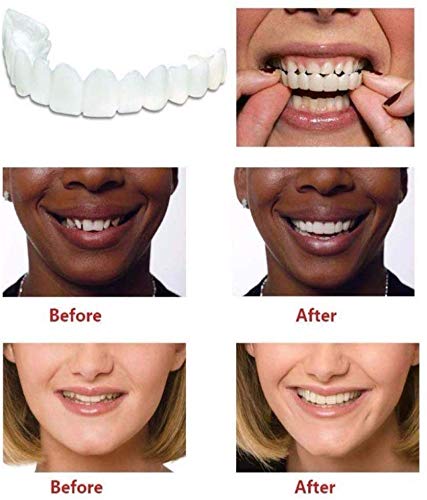 5 Pares Tirantes Carillas Dentadura Postiza Falso Dientes A Hacer Blanco Diente Hermosa Ordenado con Caja 8 Agujeros En Los Superior Dientes Y 6 6 Agujeros En Los Inferior Dientes