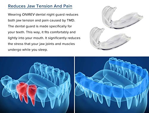 [6 en 1]Férula dental anti bruxismo - dispositivo profesional - Termosensible - nocturno - tratamiento ATM - evita el rechinar de los dientes - adultos y niños - Garantía de satisfacción al 100%