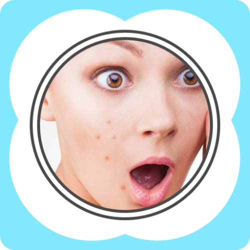 Acne - Causes of Pimples and Natural Organic Remedies to Heal Blemishes For Clear, Smooth Skin