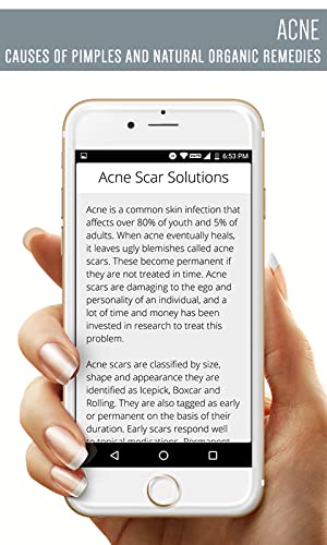 Acne - Causes of Pimples and Natural Organic Remedies to Heal Blemishes For Clear, Smooth Skin