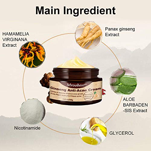 Acné Crema, Crema Antiacne, Acne Cream, Crema Para El Acné Ginseng，Equilibrio de agua y aceite, Crema contra el acné espinilla regenera la piel