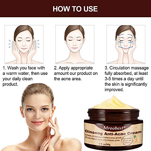 Acné Crema, Crema Antiacne, Acne Cream, Crema Para El Acné Ginseng，Equilibrio de agua y aceite, Crema contra el acné espinilla regenera la piel