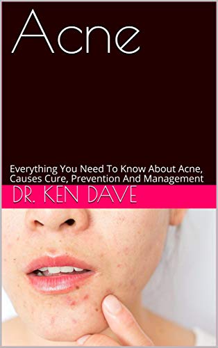 Acne: Everything You Need To Know About Acne, Causes Cure, Prevention And Management (English Edition)