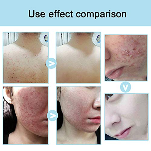 AJUMKER Jabón de sal marina Cuidado de la piel Jabón hecho a mano Leche de cabra Limpiador facial Reparación de espinillas Eliminación de poros Tratamiento del acné Hidratante Cuidado de la cara