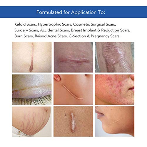 Amada pure Silicona médica de eliminación de la cicatriz extra grande hojas [5,9” x1.57” ] - rápido y eficaz en el queloide, cirugía, quemadura, 4 piezas reutilizables