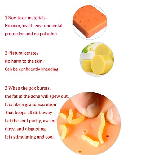Anboor Pimple Popping Plus Squeeze Divertido Juguetes para el acné Descompresión Alivio del estrés Popper Remover Deja de Escoger tu Cara