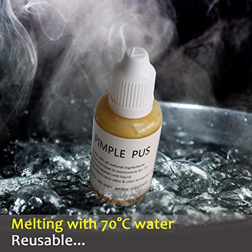 Anboor Pimple Popping Plus Squeeze Divertido Juguetes para el acné Descompresión Alivio del estrés Popper Remover Deja de Escoger tu Cara