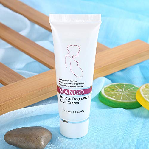 Anti-estrías posparto para diluir las estrías, reparar la crema corporal hidratante abdominal, líneas de grasa, eliminar las líneas de obesidad para reforzar los productos de prevención para