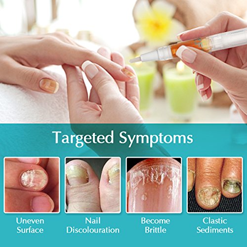 Anti Hongos Luckyfine Bolígrafo para Uñas Tratamiento Hongos Antifúngico Eficaz contra Hongo de Uñas Promueve Rebrote de Uñas Sanas Cuidado de la Reparación Natural y Seguro