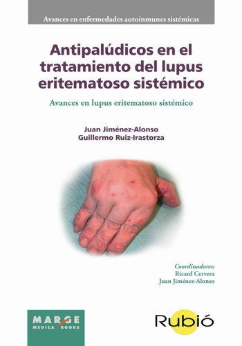 Antipalúdicos en el tratamiento del lupus eritematoso sistémico