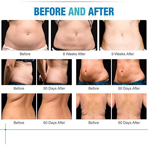 BLH-JMJ Body Shaper Pérdida de Peso, Máquina de liposucción Instrumentos de Belleza multifunción Máquina para Adelgazar Congelar Grasa Congelar el Cuerpo