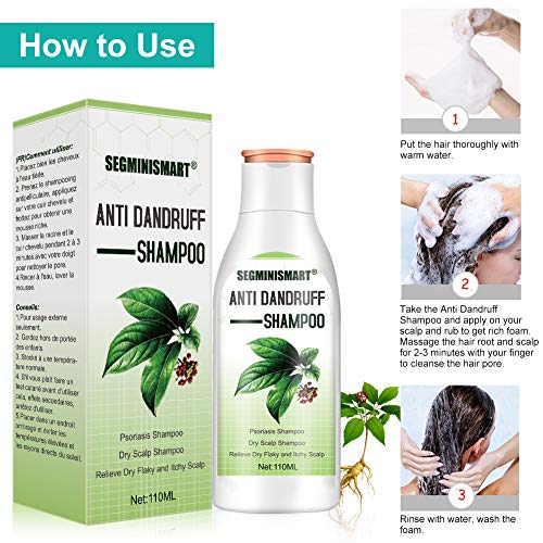 Champú anticaspa, champú para cuero cabelludo seco, alivio del cuero cabelludo seco y escamoso, tratamiento capilar para hombres y mujeres