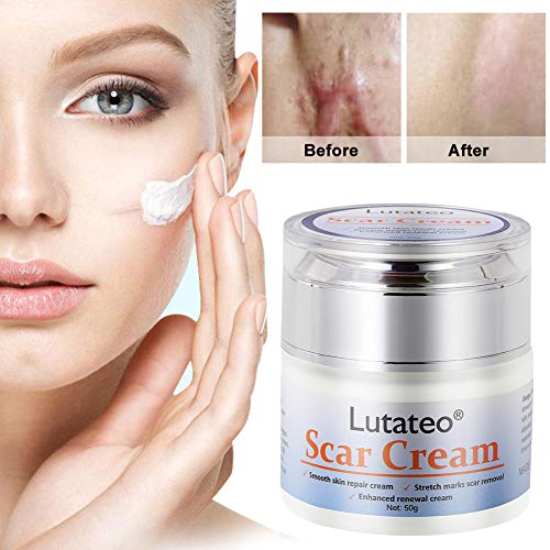 Cicatrices Crema, Crema Cicatriz, Cicatrices Tratamiento,Anti Acné Crema Reparadora Para Quemaduras,Cara Y Cuerpo, Utilízala en Cualquier Parte del Cuerpo