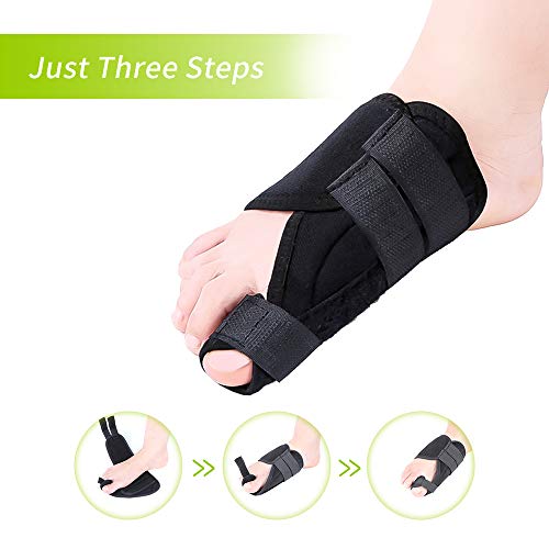 Corrector de juanetes, férula de dedo gordo para aliviar el dolor de juanetes, hallux valgus, dedos superpuestos, dedo gordo del pie, tamaño ajustable, 2 Unidades
