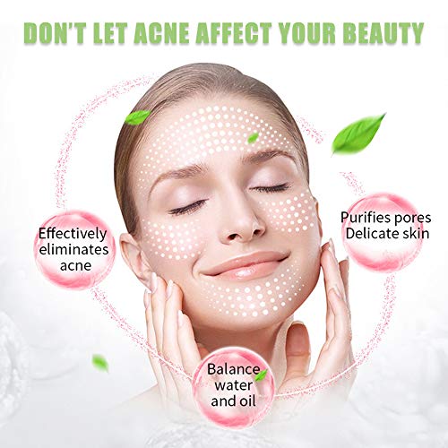 Crema Antiacne, Acné Crema, Anti Acne, Acne Tratamiento, Reducir los Puntos negros, Equilibrar el Agua y el Aceite, la Crema Contra el Acné Espinilla, Regenera la piel