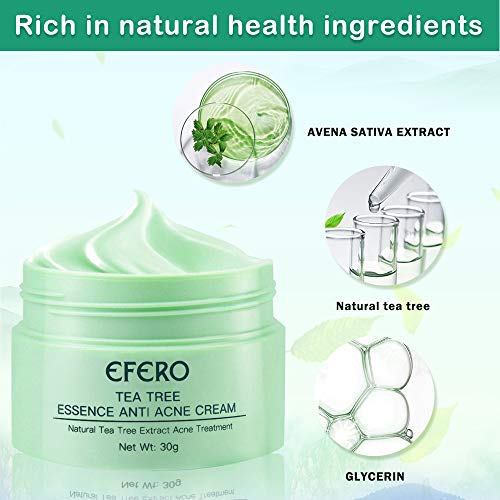 Crema Antiacne, Acné Crema, Anti Acne, Acne Tratamiento, Reducir los Puntos negros, Equilibrar el Agua y el Aceite, la Crema Contra el Acné Espinilla, Regenera la piel