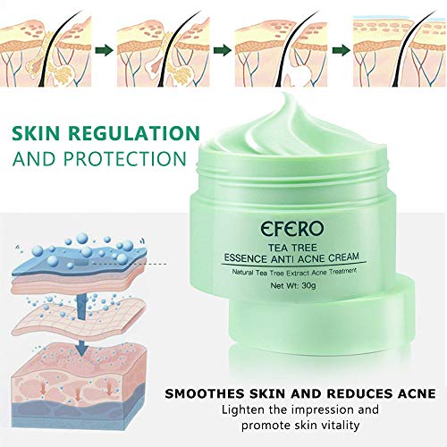 Crema Antiacne, Acné Crema, Anti Acne, Acne Tratamiento, Reducir los Puntos negros, Equilibrar el Agua y el Aceite, la Crema Contra el Acné Espinilla, Regenera la piel
