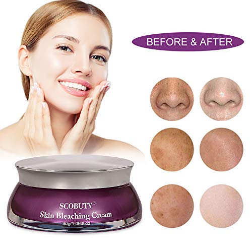 Crema Blanqueadora,Whitening Cream,Anti Manchas Cara,Anti Manchas Piel,Anti Manchas regeneradora y aclarante, Crema Hidratante Aclarante y Anti Manchas