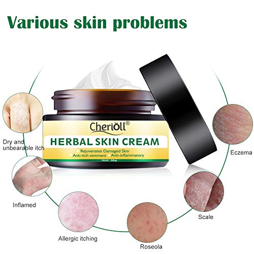 Crema para el cuerpo, tratamiento para la psoriasis, eccema, rosácea y dermatitis, la crema herbal china natural reduce la sequedad y la inflamación