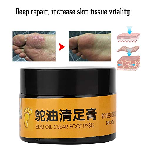 Crema para el cuidado de los pies, crema antimicótica con aceite de emú