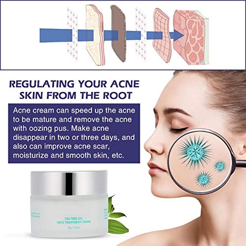 Crema Tratamiento del Acné Anti espinilla Crema para el retiro de cicatrices que blanquea el cuidado facial de la piel de la belleza, 30 g/botella