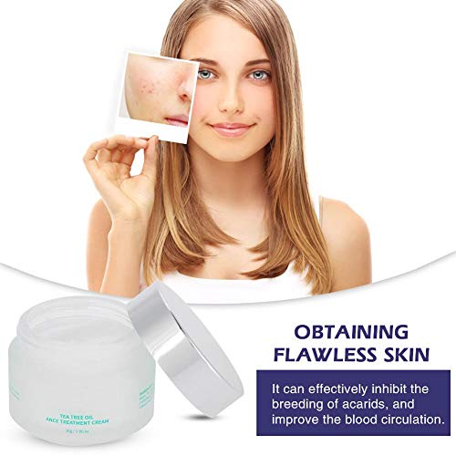 Crema Tratamiento del Acné Anti espinilla Crema para el retiro de cicatrices que blanquea el cuidado facial de la piel de la belleza, 30 g/botella