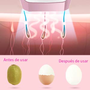 Depiladora de Luz Pulsada, IPL 1.000.000 Pulsaciones permanentes de Depilación Indolora Depiladora profesional en 10 Niveles y 2 Modos con Pantalla LCD para Hombres y Mujeres