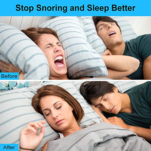 Dilatador Nasal, Antironquidos Nasal Dormir Y Dejar De Roncar, Dilatadores Nasales anti ronquido soluciones - Antirronquidos - Alivia Apnea Del Sueño, Respiración Fuerte Y Congestión Nasal