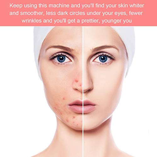 Dispositivo de tonificación mediante vibraciones, para la cara, con efecto frío y calor, masajeador facial RF, con iones de 7 °, 46 °, blanquea la piel, elimina arrugas y ojeras