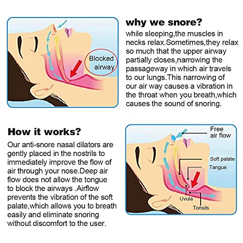 Dispositivos Anti Ronquido, Dilatador Nasal Purificador de Aire Solución Premium Ronquidos Alivia Apnea Del Sueño, Respiración Fuerte Y Congestión Nasal