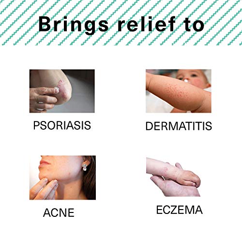 Eczema crema de cannabis – 200-250 mg DBC – Pomada de aceite de cáñamo organico para los problemas de piel – 50 ml – Trata la psoriasis
