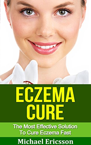 Eczema Cure: The Most Effective Solution To Cure Eczema Fast: A Guide To Eczema Treatment, Eczema Cure And Eczema Remedies For Perfect Clear Skin (Eczema, ... Seborrheic Dermatitis) (English Edition)