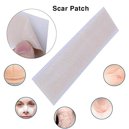 Eliminación de cicatrices Lámina de gel de silicona Marcas de heridas Parches de sección cesárea