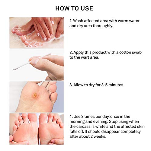 Eliminación de verrugas Avashine, elimina sin dolor las verrugas comunes, manos y plantares, líquido de verrugas de máxima fuerza, fuerte y eficaz tratamiento de infección de verrugas