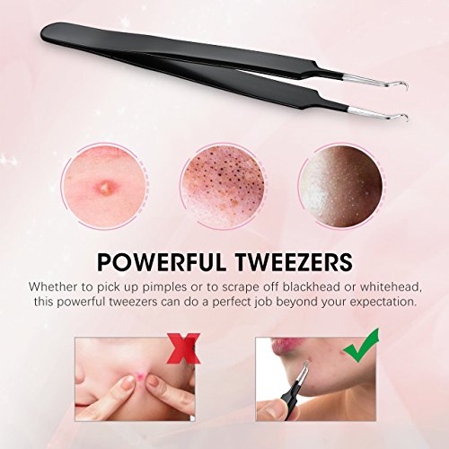 ellesye Blackhead eliminación Kit, 6 piezas Juego de herramientas, acero inoxidable, extractor de comedones, Whitehead mancha de puntos negros acné remover granulada, finamente pulido mango