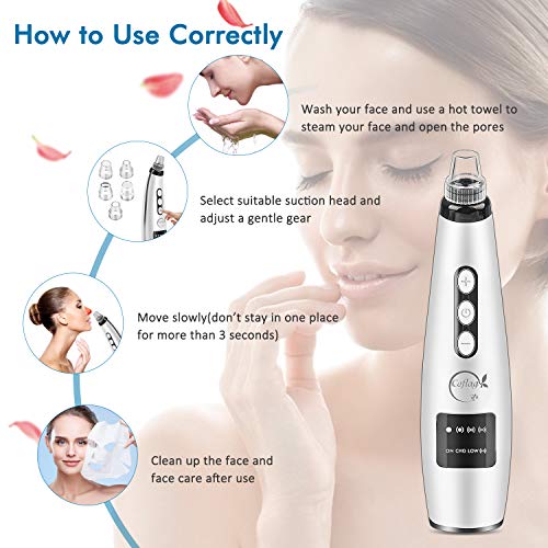 ETEPON Limpiador de Poros, Succionador de Puntos Negros con 5 Cabezales de Succión Reemplazables EJHF-15