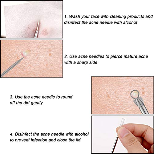 Extractor Puntos Negros Limpiador 7PCS Cejas Pinzas de Depilar para Acné Acero INOX Aguja Extractor Acné Limpiador Puntos Negros Profesional para Espinillas Acné, Puntos Blancos, Granos Zit Encarnados