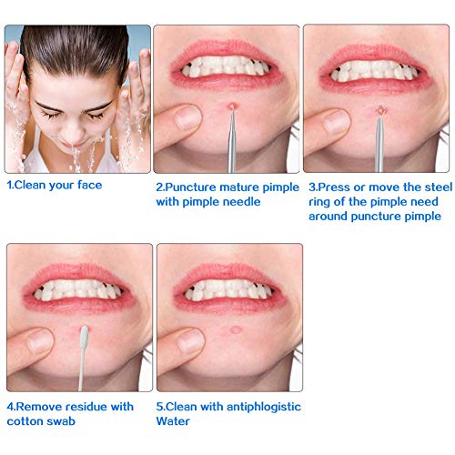 falllea 10 Piezas de Aguja Extractor Limpiador Negros Comedones Extractor Herramientas Juego de Removedor de Espinillas Aguja de Acné para Quita Espinillas Granos Comedones