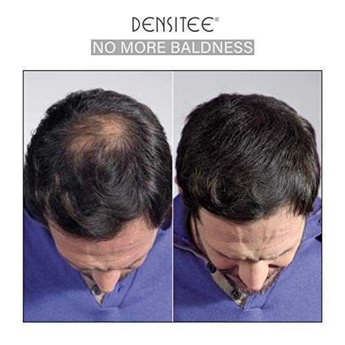 Fibras Capilares Color Negro 28 gr Queratina Caida de Cabello Keratin Fibers Perdida de Cabello Hombres y Mujeres Retoca Raices y Canas Disimula al Instante Calvicie DENSITEE